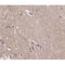 AF0168 at 1/200 staining human brain tissue sections by IHC-P. The tissue was formaldehyde fixed and a heat mediated antigen retrieval step in citrate buffer was performed. The tissue was then blocked and incubated with the antibody for 1.5 hours at 22¡ãC. An HRP conjugated goat anti-rabbit antibody was used as the secondary