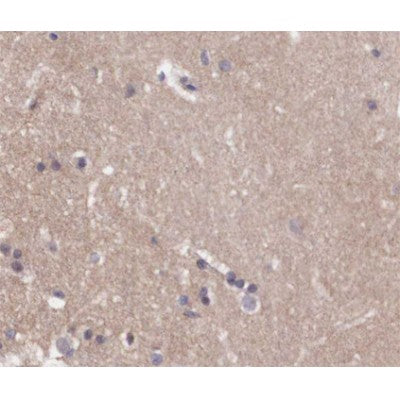 AF0168 at 1/200 staining human brain tissue sections by IHC-P. The tissue was formaldehyde fixed and a heat mediated antigen retrieval step in citrate buffer was performed. The tissue was then blocked and incubated with the antibody for 1.5 hours at 22¡ãC. An HRP conjugated goat anti-rabbit antibody was used as the secondary