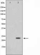 Western blot analysis on COLO205 cell lysate using LDOC1L Antibody,The lane on the left is treated with the antigen-specific peptide.