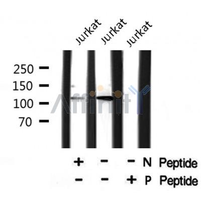 AF8013 staining HeLa by IF/ICC. The sample were fixed with PFA and permeabilized in 0.1% Triton X-100,then blocked in 10% serum for 45 minutes at 25¡ãC. The primary antibody was diluted at 1/200 and incubated with the sample for 1 hour at 37¡ãC. An  Alexa Fluor 594 conjugated goat anti-rabbit IgG (H+L) Ab, diluted at 1/600, was used as the secondary antibod