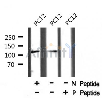 AF8014 staining HeLa by IF/ICC. The sample were fixed with PFA and permeabilized in 0.1% Triton X-100,then blocked in 10% serum for 45 minutes at 25¡ãC. The primary antibody was diluted at 1/200 and incubated with the sample for 1 hour at 37¡ãC. An  Alexa Fluor 594 conjugated goat anti-rabbit IgG (H+L) Ab, diluted at 1/600, was used as the secondary antibod