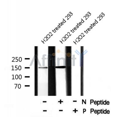 AF8018 staining HepG2 cells by IF/ICC. The sample were fixed with PFA and permeabilized in 0.1% Triton X-100,then blocked in 10% serum for 45 minutes at 25¡ãC. The primary antibody was diluted at 1/200 and incubated with the sample for 1 hour at 37¡ãC. An  Alexa Fluor 594 conjugated goat anti-rabbit IgG (H+L) antibody(Cat.