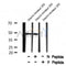 Western blot analysis of Doublecortin (Phospho-Ser378) using Insulin treated 293 whole cell lysates