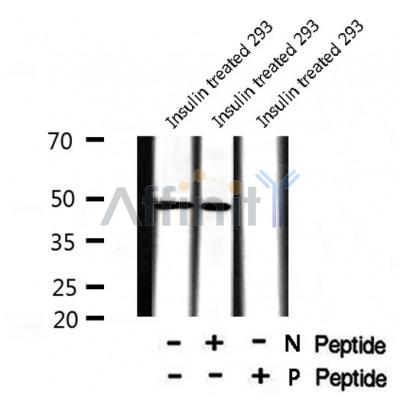 Western blot analysis of Doublecortin (Phospho-Ser378) using Insulin treated 293 whole cell lysates