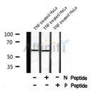 Western blot analysis of PAK4/5/6 (Phospho-Ser474) using TNF treated HeLa whole cell lysates