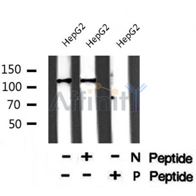 Western blot analysis of RBL2 (Phospho-Ser952) using HepG2 whole cell lysates