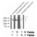 Western blot analysis of CD130/gp130 (Phospho-Ser782) using nocodazole treated HeLa whole cell lysates