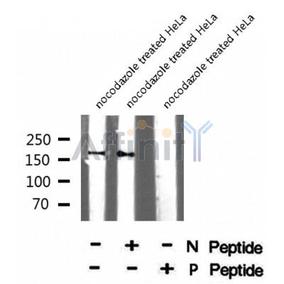 Western blot analysis of CD130/gp130 (Phospho-Ser782) using nocodazole treated HeLa whole cell lysates
