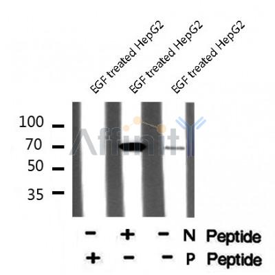 AF8039 at 1/200 staining Rat kidney tissue sections by IHC-P. The tissue was formaldehyde fixed and a heat mediated antigen retrieval step in citrate buffer was performed. The tissue was then blocked and incubated with the antibody for 1.5 hours at 22¡ãC. An HRP conjugated goat anti-rabbit antibody was used as the secondary