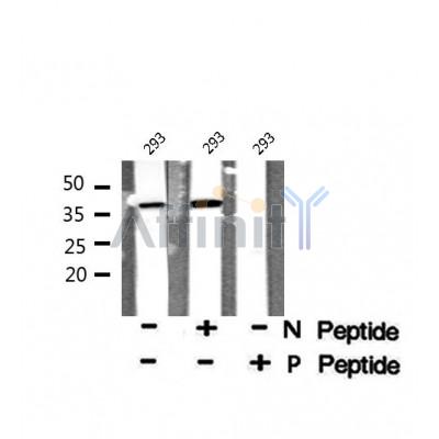 AF8043 at 1/200 staining Rat lung tissue sections by IHC-P. The tissue was formaldehyde fixed and a heat mediated antigen retrieval step in citrate buffer was performed. The tissue was then blocked and incubated with the antibody for 1.5 hours at 22¡ãC. An HRP conjugated goat anti-rabbit antibody was used as the secondary