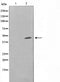 AF0767 staining COLO205 by IF/ICC. The sample were fixed with PFA and permeabilized in 0.1% Triton X-100,then blocked in 10% serum for 45 minutes at 25¡ãC. The primary antibody was diluted at 1/200 and incubated with the sample for 1 hour at 37¡ãC. An  Alexa Fluor 594 conjugated goat anti-rabbit IgG (H+L) Ab, diluted at 1/600, was used as the secondary antibod