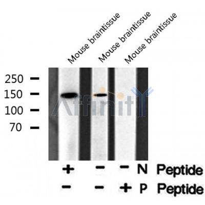 AF8050 staining HuvEc by IF/ICC. The sample were fixed with PFA and permeabilized in 0.1% Triton X-100,then blocked in 10% serum for 45 minutes at 25¡ãC. The primary antibody was diluted at 1/200 and incubated with the sample for 1 hour at 37¡ãC. An  Alexa Fluor 594 conjugated goat anti-rabbit IgG (H+L) Ab, diluted at 1/600, was used as the secondary antibod