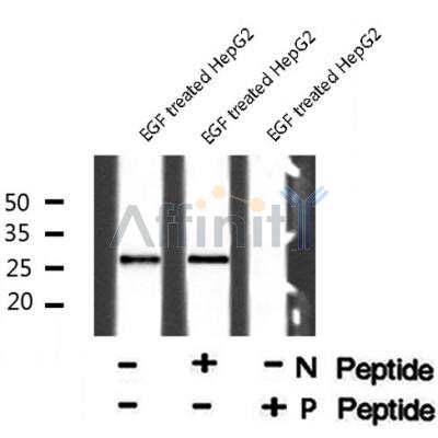 Western blot analysis of extracts from rat brain, using p27 Kip1 (Phospho-Ser178) Antibody. Lane 1 was treated with the blocking peptide.