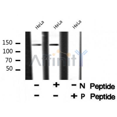 AF8053 at 1/200 staining Rat ganstric tissue sections by IHC-P. The tissue was formaldehyde fixed and a heat mediated antigen retrieval step in citrate buffer was performed. The tissue was then blocked and incubated with the antibody for 1.5 hours at 22¡ãC. An HRP conjugated goat anti-rabbit antibody was used as the secondary