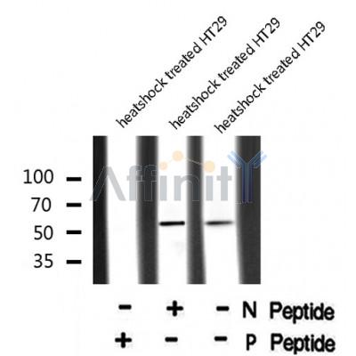 AF8059 staining HepG2 by IF/ICC. The sample were fixed with PFA and permeabilized in 0.1% Triton X-100,then blocked in 10% serum for 45 minutes at 25¡ãC. The primary antibody was diluted at 1/200 and incubated with the sample for 1 hour at 37¡ãC. An  Alexa Fluor 594 conjugated goat anti-rabbit IgG (H+L) Ab, diluted at 1/600, was used as the secondary antibod