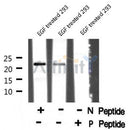 AF8061 at 1/200 staining Rat ganstric tissue sections by IHC-P. The tissue was formaldehyde fixed and a heat mediated antigen retrieval step in citrate buffer was performed. The tissue was then blocked and incubated with the antibody for 1.5 hours at 22¡ãC. An HRP conjugated goat anti-rabbit antibody was used as the secondary