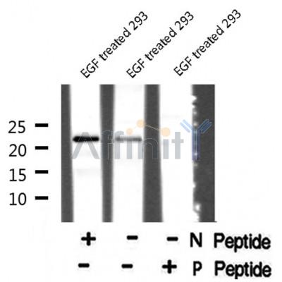AF8061 at 1/200 staining Rat ganstric tissue sections by IHC-P. The tissue was formaldehyde fixed and a heat mediated antigen retrieval step in citrate buffer was performed. The tissue was then blocked and incubated with the antibody for 1.5 hours at 22¡ãC. An HRP conjugated goat anti-rabbit antibody was used as the secondary
