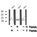 Western blot analysis of HAND1 (Phospho-Ser98) using HeLa whole cell lysates