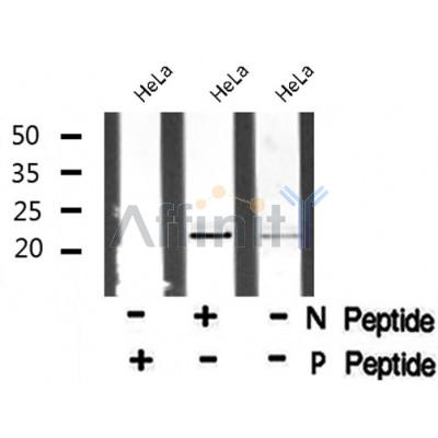 Western blot analysis of HAND1 (Phospho-Ser98) using HeLa whole cell lysates