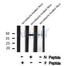 AF8064 at 1/200 staining Rat kidney tissue sections by IHC-P. The tissue was formaldehyde fixed and a heat mediated antigen retrieval step in citrate buffer was performed. The tissue was then blocked and incubated with the antibody for 1.5 hours at 22¡ãC. An HRP conjugated goat anti-rabbit antibody was used as the secondary