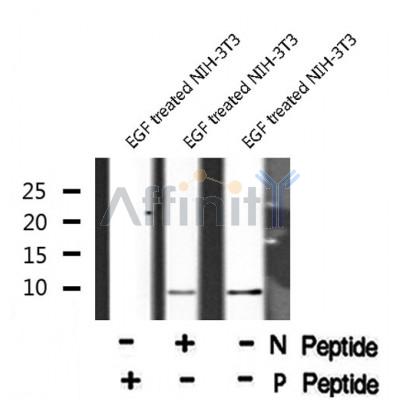 AF8065 at 1/200 staining Rat lung tissue sections by IHC-P. The tissue was formaldehyde fixed and a heat mediated antigen retrieval step in citrate buffer was performed. The tissue was then blocked and incubated with the antibody for 1.5 hours at 22¡ãC. An HRP conjugated goat anti-rabbit antibody was used as the secondary