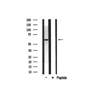 AF0600 staining HepG2 by IF/ICC. The sample were fixed with PFA and permeabilized in 0.1% Triton X-100,then blocked in 10% serum for 45 minutes at 25¡ãC. The primary antibody was diluted at 1/200 and incubated with the sample for 1 hour at 37¡ãC. An  Alexa Fluor 594 conjugated goat anti-rabbit IgG (H+L) Ab, diluted at 1/600, was used as the secondary antibod