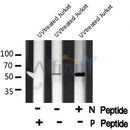 AF8066 at 1/200 staining Rat kidney tissue sections by IHC-P. The tissue was formaldehyde fixed and a heat mediated antigen retrieval step in citrate buffer was performed. The tissue was then blocked and incubated with the antibody for 1.5 hours at 22¡ãC. An HRP conjugated goat anti-rabbit antibody was used as the secondary