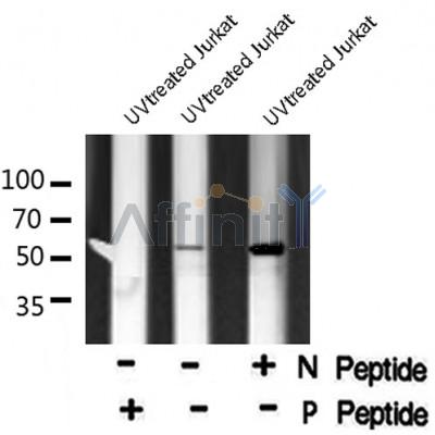 AF8066 at 1/200 staining Rat kidney tissue sections by IHC-P. The tissue was formaldehyde fixed and a heat mediated antigen retrieval step in citrate buffer was performed. The tissue was then blocked and incubated with the antibody for 1.5 hours at 22¡ãC. An HRP conjugated goat anti-rabbit antibody was used as the secondary