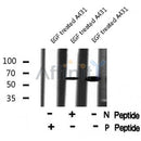 Western blot analysis IL-1R?/CD121? (Phospho-Tyr496) using EGF treated A431 whole cell lysates