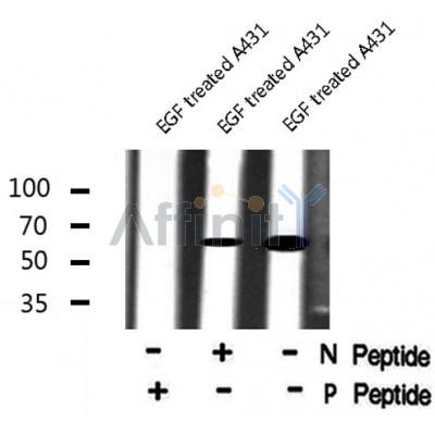 Western blot analysis IL-1R?/CD121? (Phospho-Tyr496) using EGF treated A431 whole cell lysates