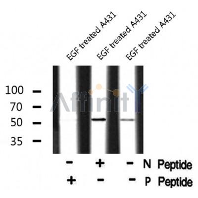 AF8070 at 1/200 staining Rat kidney tissue sections by IHC-P. The tissue was formaldehyde fixed and a heat mediated antigen retrieval step in citrate buffer was performed. The tissue was then blocked and incubated with the antibody for 1.5 hours at 22¡ãC. An HRP conjugated goat anti-rabbit antibody was used as the secondary