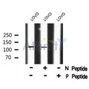 Western blot analysis of MAP4 (Phospho-Ser696) using LOVO whole cell lysates