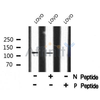 Western blot analysis of MAP4 (Phospho-Ser696) using LOVO whole cell lysates