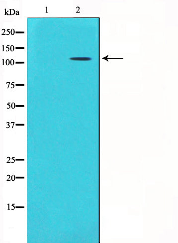 Western blot analysis on mouse brain lysate using GluR5 Antibody,The lane on the left is treated with the antigen-specific peptide.