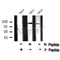 AF8076 at 1/200 staining Rat lung tissue sections by IHC-P. The tissue was formaldehyde fixed and a heat mediated antigen retrieval step in citrate buffer was performed. The tissue was then blocked and incubated with the antibody for 1.5 hours at 22¡ãC. An HRP conjugated goat anti-rabbit antibody was used as the secondary