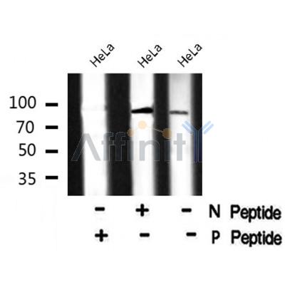AF8076 at 1/200 staining Rat lung tissue sections by IHC-P. The tissue was formaldehyde fixed and a heat mediated antigen retrieval step in citrate buffer was performed. The tissue was then blocked and incubated with the antibody for 1.5 hours at 22¡ãC. An HRP conjugated goat anti-rabbit antibody was used as the secondary