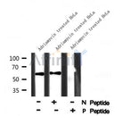 Western blot analysis of TGF ? Receptor I (Phospho-Ser165) using Adriamycin treated HeLa whole cell lysates