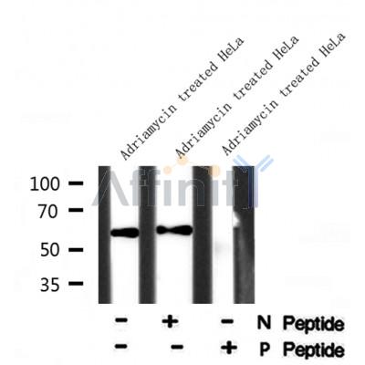 Western blot analysis of TGF ? Receptor I (Phospho-Ser165) using Adriamycin treated HeLa whole cell lysates