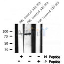Western blot analysis of Centaurin-?1 (Phospho-Ser554) using PMA treated NIH-3T3 whole cell lysates