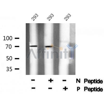 AF8087 at 1/200 staining Rat brain tissue sections by IHC-P. The tissue was formaldehyde fixed and a heat mediated antigen retrieval step in citrate buffer was performed. The tissue was then blocked and incubated with the antibody for 1.5 hours at 22¡ãC. An HRP conjugated goat anti-rabbit antibody was used as the secondary