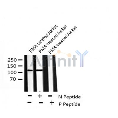 AF8091 at 1/200 staining Rat lung tissue sections by IHC-P. The tissue was formaldehyde fixed and a heat mediated antigen retrieval step in citrate buffer was performed. The tissue was then blocked and incubated with the antibody for 1.5 hours at 22¡ãC. An HRP conjugated goat anti-rabbit antibody was used as the secondary