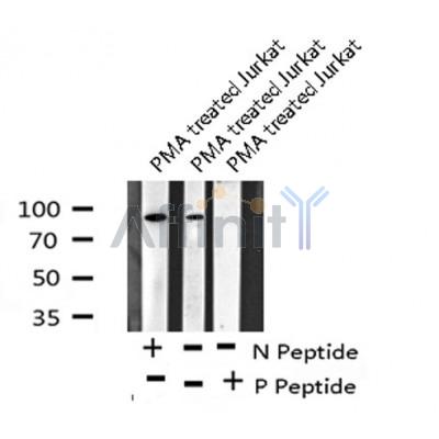 Western blot analysis of PKD2 (Phospho-Ser812) using PMA treated Jurkat whole cell lysates