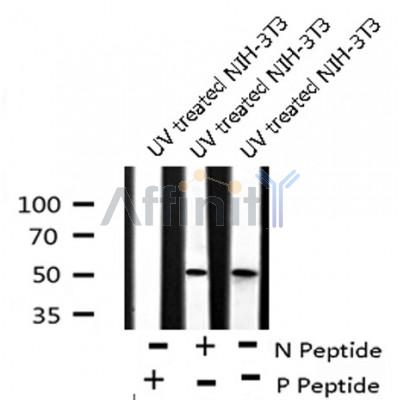 Western blot analysis of Presenilin 2 (Phospho-Ser330) using UV treated NIH-3T3 whole cell lysates