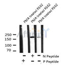 AF8096 staining MDA-MB-435 by IF/ICC. The sample were fixed with PFA and permeabilized in 0.1% Triton X-100,then blocked in 10% serum for 45 minutes at 25¡ãC. The primary antibody was diluted at 1/200 and incubated with the sample for 1 hour at 37¡ãC. An  Alexa Fluor 594 conjugated goat anti-rabbit IgG (H+L) Ab, diluted at 1/600, was used as the secondary antibod