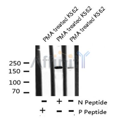 AF8096 staining MDA-MB-435 by IF/ICC. The sample were fixed with PFA and permeabilized in 0.1% Triton X-100,then blocked in 10% serum for 45 minutes at 25¡ãC. The primary antibody was diluted at 1/200 and incubated with the sample for 1 hour at 37¡ãC. An  Alexa Fluor 594 conjugated goat anti-rabbit IgG (H+L) Ab, diluted at 1/600, was used as the secondary antibod