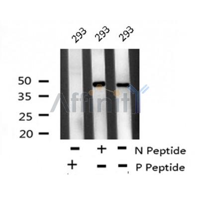 Western blot analysis of ATF-4 (Phospho-Ser219) using 293 whole cell lysates
