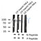 AF8101 staining SW626 by IF/ICC. The sample were fixed with PFA and permeabilized in 0.1% Triton X-100,then blocked in 10% serum for 45 minutes at 25¡ãC. The primary antibody was diluted at 1/200 and incubated with the sample for 1 hour at 37¡ãC. An  Alexa Fluor 594 conjugated goat anti-rabbit IgG (H+L) Ab, diluted at 1/600, was used as the secondary antibod