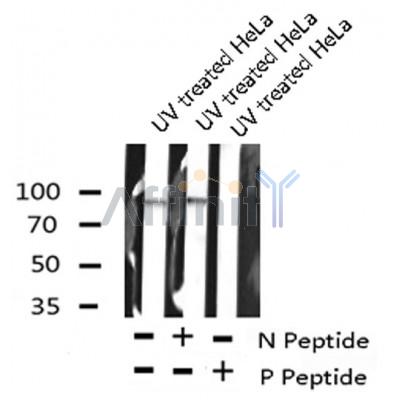 AF8101 staining SW626 by IF/ICC. The sample were fixed with PFA and permeabilized in 0.1% Triton X-100,then blocked in 10% serum for 45 minutes at 25¡ãC. The primary antibody was diluted at 1/200 and incubated with the sample for 1 hour at 37¡ãC. An  Alexa Fluor 594 conjugated goat anti-rabbit IgG (H+L) Ab, diluted at 1/600, was used as the secondary antibod