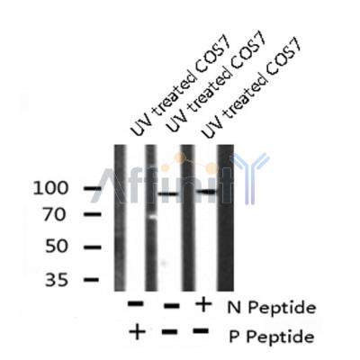 AF8102 staining SW626 by IF/ICC. The sample were fixed with PFA and permeabilized in 0.1% Triton X-100,then blocked in 10% serum for 45 minutes at 25¡ãC. The primary antibody was diluted at 1/200 and incubated with the sample for 1 hour at 37¡ãC. An  Alexa Fluor 594 conjugated goat anti-rabbit IgG (H+L) Ab, diluted at 1/600, was used as the secondary antibod