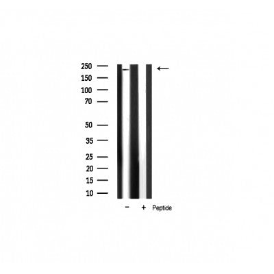 AF0666 at 1/100 staining Rat brain tissue by IHC-P. The sample was formaldehyde fixed and a heat mediated antigen retrieval step in citrate buffer was performed. The sample was then blocked and incubated with the antibody for 1.5 hours at 22¡ãC. An HRP conjugated goat anti-rabbit antibody was used as the secondary